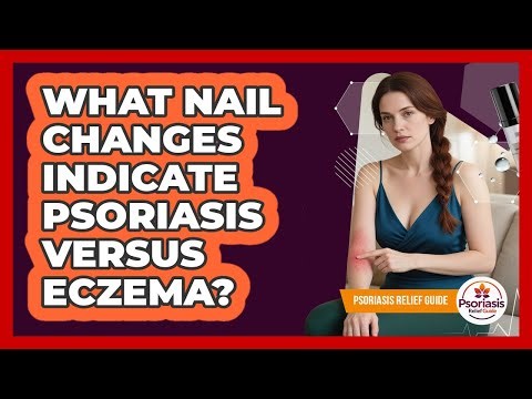 What Nail Changes Indicate Psoriasis Versus Eczema?