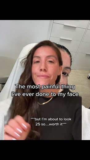 Halo Laser Treatment Review: Painful But Promising Results