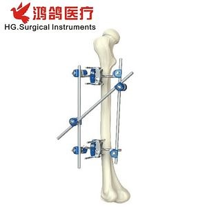 [Hot Item] Orthopedic Instrument Combination External Fixator Orthopedic Product Medical Supply Hospital Equipment