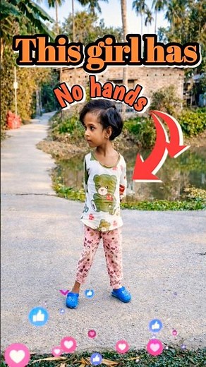 This girl has no hands #viral #shortvideos #kids #memes #most #nohands#doctor #eyecatchy