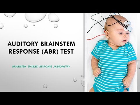 Auditory Brainstem Response ABR Test | Brainstem evoked response audiometry| LABAT ABR