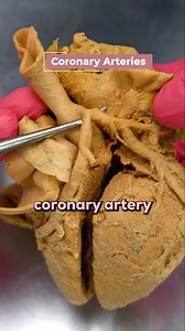 247K views · 4.5K reactions | What Actually Causes a Heart Attack? 變...