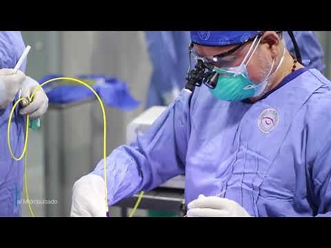 Ciclofotocoagulación Transescleral Micropulse CYCLO G6 / Cirugía Láser de Glaucoma - Vidava's