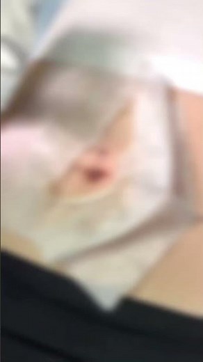 Floating Navel Piercing using Hypochlorous Acid Spray 🍃