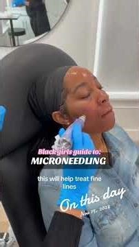Microneedling for Melanin: Safe, Effective & Black-Girl Friendly ✨ | Glow Up Series