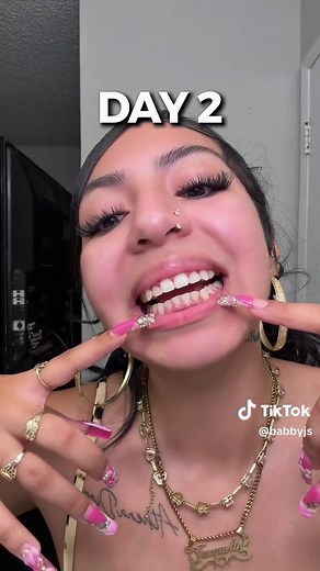 BIXDO Blue Light Whitening Toothbrush: Fast Results