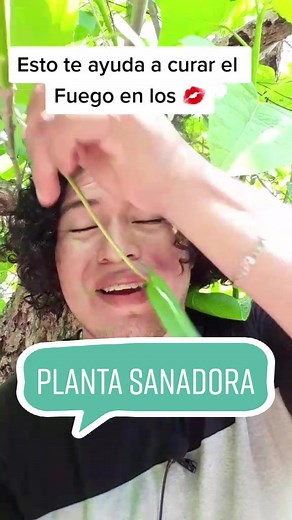 Remedios Naturales para el Fuego en los Labios
