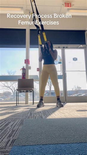 Recovery Process Broken Femur Exercises #recovery #process #femur #rehabilitation #exercise