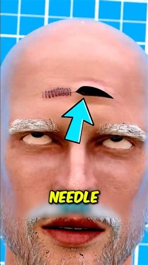 What Really Happens When You Get Stitches 😱 #MedicalFacts#HumanBody#DidYouKnow