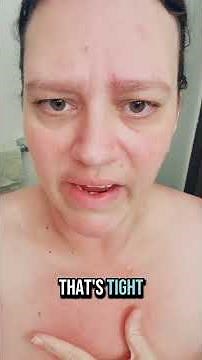 TW: POST MASTECTOMY SURGICAL SCAR