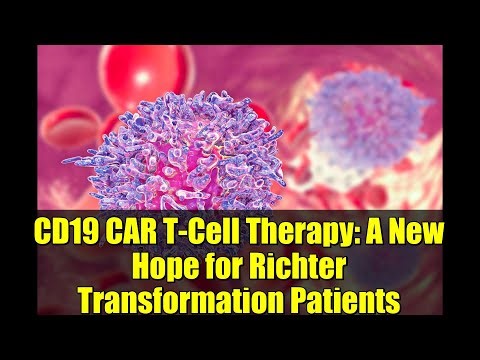 CD19 CAR T-Cell Therapy: A New Hope for Richter Transformation Patients