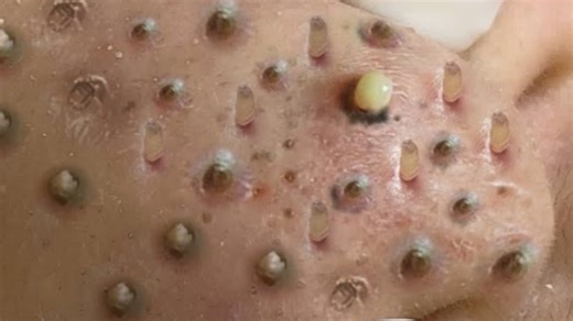 ?uid=425631784B77676571453258