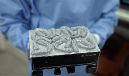 High-Throughput Clear Aligner Manufacturing With Print Settings Editor