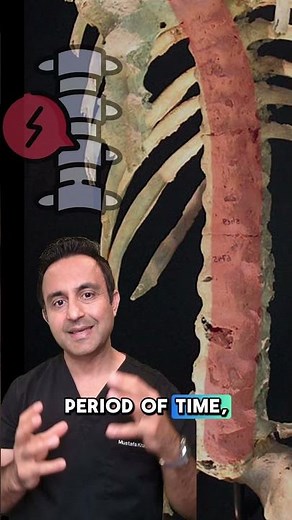 bamboo-spine disease #ankylosingspondylitis