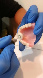 Learn More about affordable denture options designed specifically for seniors, providing a comfortable fit, natural look, and improved quality of life. Discover how custom-made dentures can help restore confidence, enhance nutrition, and promote overall well-being. Learn More | Adepty Buzz