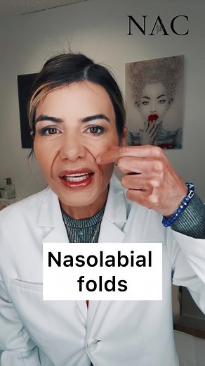 Nasolabial Folds Treatment with Dr. Bitafarrell at Natural Aesthetics Center