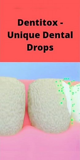 How to take care of teeth? Dentitox -Unique Dental Drops #Shorts