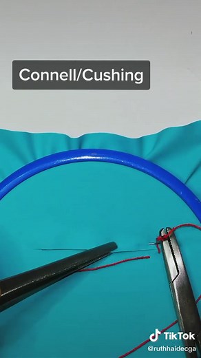 Connell/Cushing Suture: Techniques and Patterns Explained