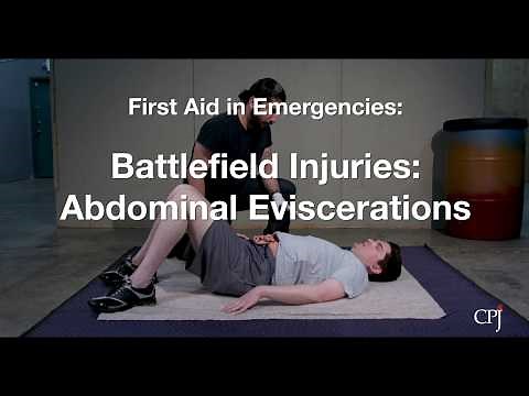 9b. Battlefield Injuries: Abdominal Eviscerations