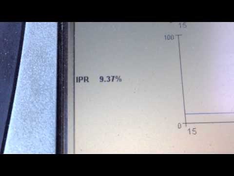 P1211, lack of power on a Ford 7.3 powerstroke diesel. Due to oil.