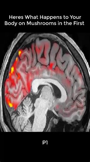 Heres What Happens to Your Body on Mushrooms in the First 24 Hours