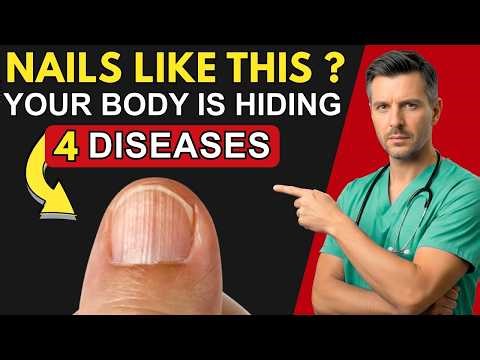 Neurologist WARNS: If Your NAILS Look Like THIS After 60, Your Body Can be Hiding 4 Diseases.
