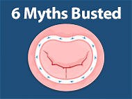 Adam's Heart Valve Surgery Videos