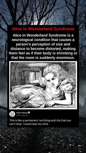 Alice in Wonderland Syndrome is a neurological condition that causes a person's perception of