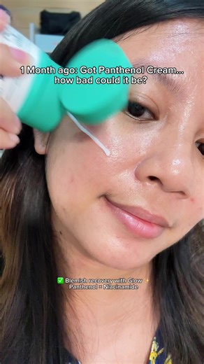1 Month ago: Got Panthenol Cream… how bad could it be? Me now: Nothing could go wrong 🌿 Main Benefits: ✔ Blemish recovery with Glow — Panthenol × Niacinamide ✔ *Real Post-Acne Cream — No silicone, no alcohol, no phenoxyethanol Blemish out, Glow on (10% Panthenol) 🏷️ @purito_official #Purito #PanthenolCream #AcneTreatment #RealPostAcneCream #RealPostAcneCreamChallenge