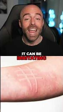 Dermatographia & Stendhal Syndrome: Weird Body Reactions Explained!