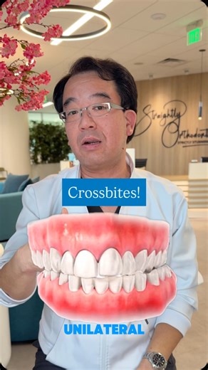 STRAIGHTLY ORTHODONTICS ~ Strictly Stunning Smiles on Instagram: "Crossbite correction in action! Here’s how we use elastics to guide your teeth into perfect alignment 💫 #orthodontist #braces #invisalign #crossbite #orthotips #straightlyorthodontics"