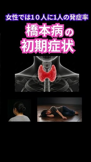 📌 女性の10人に1人が発症すると言われる橋本病 #病気 #健康 #橋本病 #甲状腺 #甲状腺機能低下症