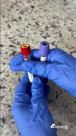 Red Top vs. Purple Top Tubes – What’s the Difference? 🩸🧪