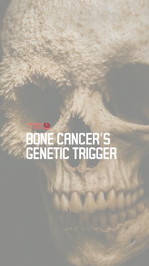 Bone Cancer’s Genetic Trigger - What if bone pain, swelling, and fatigue were all clues to a deeper genetic chaos—like the loss-translocation-amplification pattern uncovered by researchers at University College London—hinting at how aggressive osteosarcoma really grows? If you’re enjoying the content and want to support us, consider subscribing! https://www.facebook.com/thebrainmazeofficial/subscribe/ | The Brain Maze