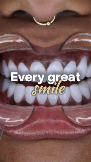Transform Your Smile at Dental Design in Miami
