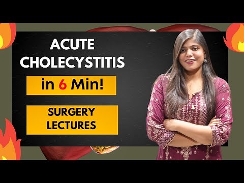 Acute Cholecystitis - Clinical Features Diganosis and Treatment | Surgery Lectures and Notes | MBBS