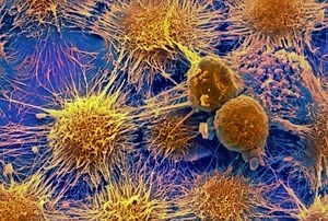 Study Shows New Way Forward for Personalized Cancer Treatmen | Cancer