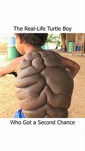 The Real-Life Turtle Boy Who Got a Second Chance! | Safari Sarraah