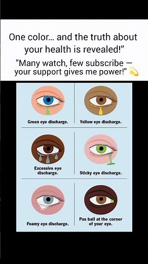 Types of Eye Discharge