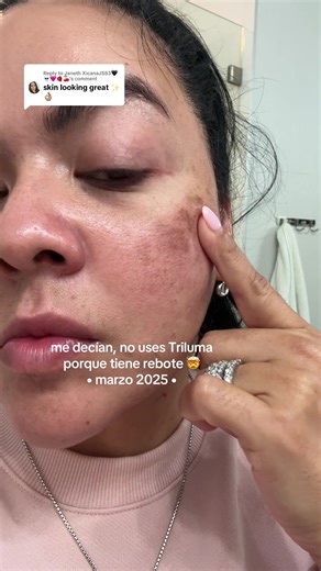 Replying to @Janeth XicanaJS83🖤💀🩷🍓🍒 thank you! Been consistent full year BIG difference in my skincare journey 🧖🏻‍♀️🫧🤍🫶🏼 #skincarejourney #melasma #melasmatreatment #mancha #manchasenlapiel