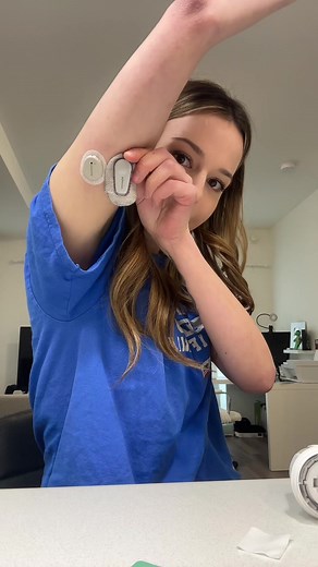 Applying a DEXCOM G7 for Diabetes Management