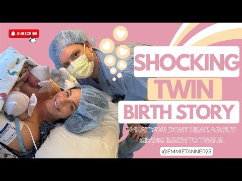Transverse Twin Birth — Here's What Actually Happened