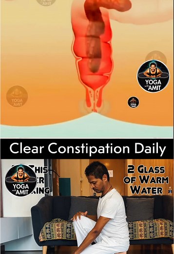 Effective Yoga Techniques for Relieving Constipation