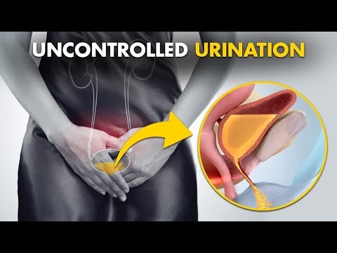 Urinary Incontinence Explained: Types, Causes, and Effective Treatments