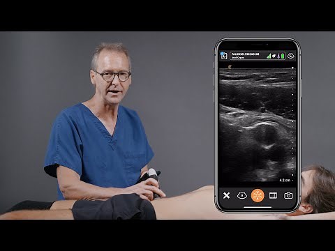 Scanning the Appendix