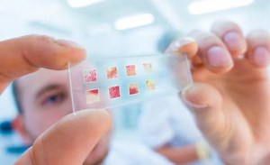 Biópsia: por que é solicitado, como é feito e riscos do exame