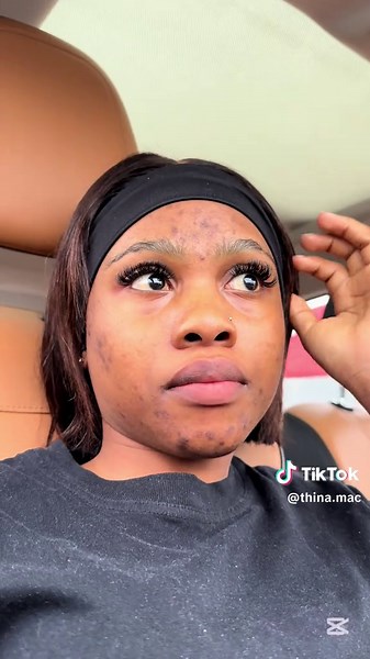 Challenges of Capturing a Vlog with Limited Storage