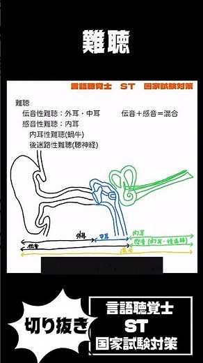 伝音性難聴と感音性難聴の違い 滲出性中耳炎 メニエール病 薬剤性難聴 機能性難聴 加齢性難聴