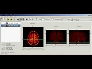 AMIDE 3D Imaging Software