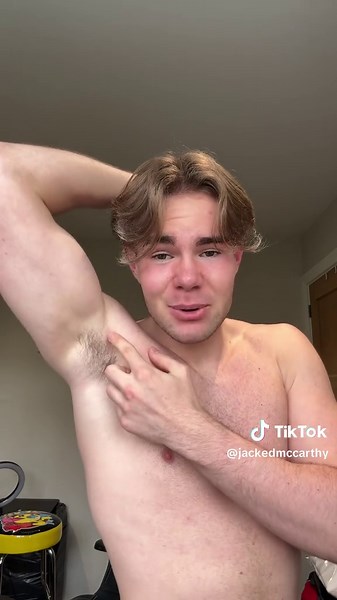 Facing My Worst Nightmare: Pec Injury After Weighted Dips